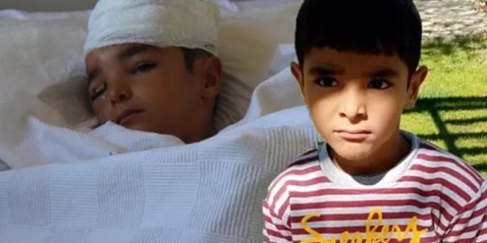 6 yaşındaki çocuk dehşeti yaşadı! Kafa derisinin sağ tarafı soyuldu