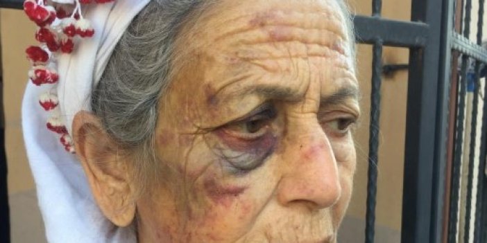 Kanser hastası yaşlı kadını dakikalarca dövüp gasp etti 
