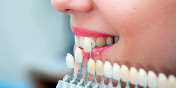 Zirkonyum diş kaplaması nedir?
