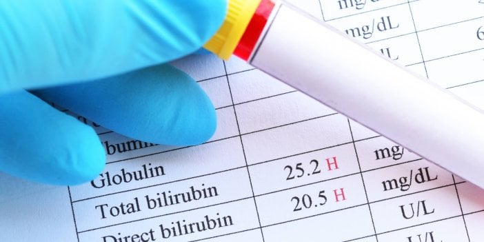 Bilirubin nedir, yükselirse nasıl düşer