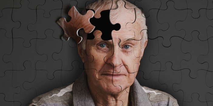 Alzheimer tedavi yöntemleri nelerdir?