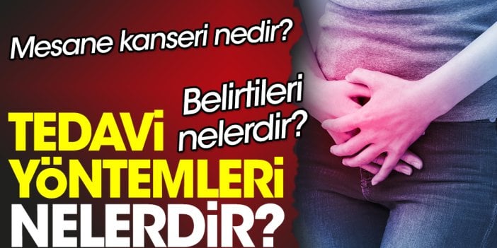 Mesane kanseri nedir? Belirtileri nelerdir? Tedavi yöntemleri nelerdir?