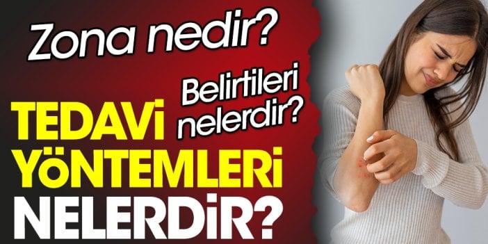 Zona nedir? Zona belirtileri nelerdir? Zona tedavi yöntemleri nelerdir?