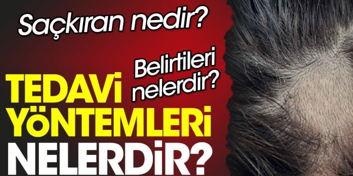 Saçkıran nedir? Saçkıran belirtileri nelerdir? Saçkıran tedavi yöntemleri nelerdir?