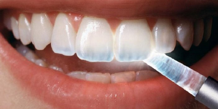 Dişlerinizin aşınması neyin habercisi