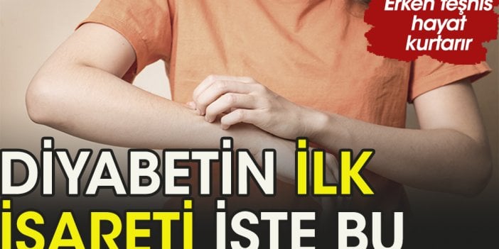 Bu belirti diyabetin ilk habercisi