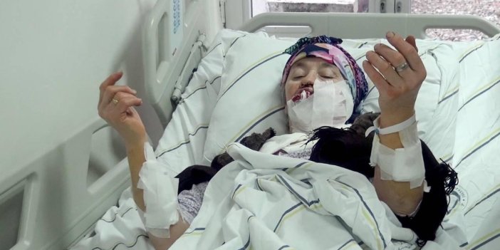 Erzurum'da 4 kişiyi yaralayan kurt kuduz çıktı 