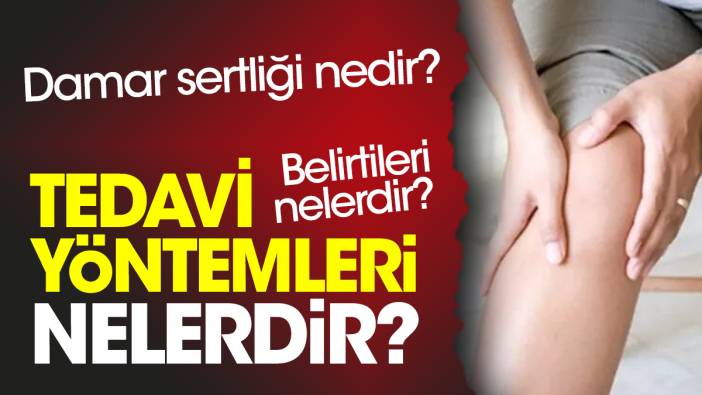 Damar sertliği nedir? Damar sertliği belirtileri nelerdir? Damar sertliği tedavi yöntemleri nelerdir?