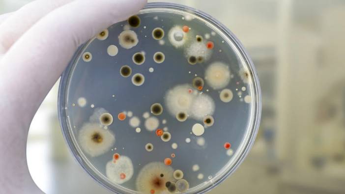 Yapay zeka antibiyotiğe direnç gösteren zehirli bakteriyi öldürecek. Kesin tedavi sunacak