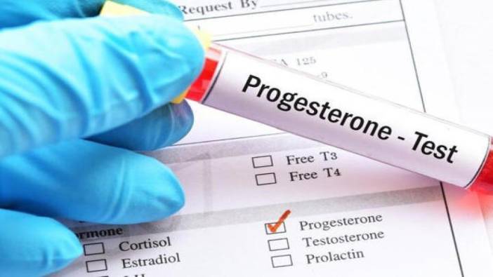 Progesteron hormonu nedir? Progesteron hormon değeri kaç olmalıdır?