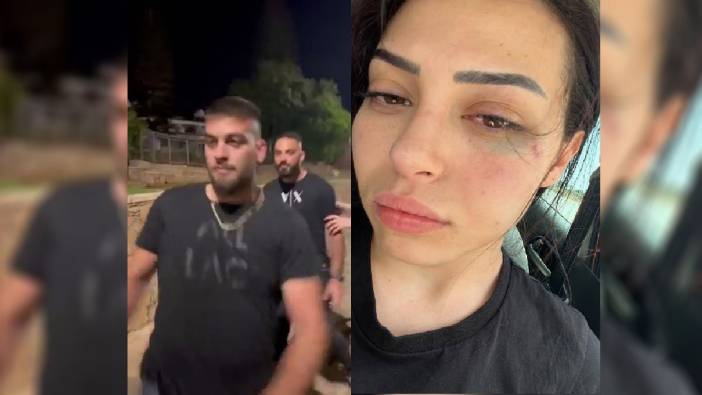 Güney Kıbrıs Rum Kesimi’nde Türk kızına saldırı. 2 Rum gözaltında