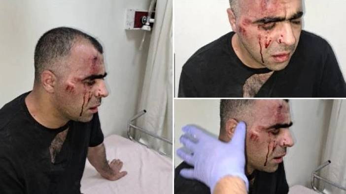 Yolsuzluk haberi yaptığı için belediye başkanının dövdürdüğü gazeteci yeni bombayı patlattı