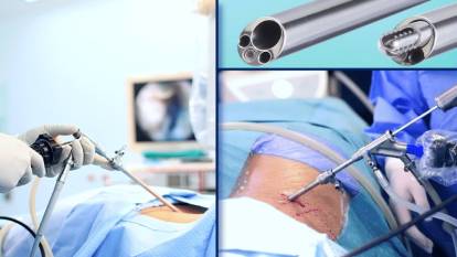 İşte bel fıtığının çaresi Endoskopik omurga cerrahisi bel fıtığına kesin çözüm mü?