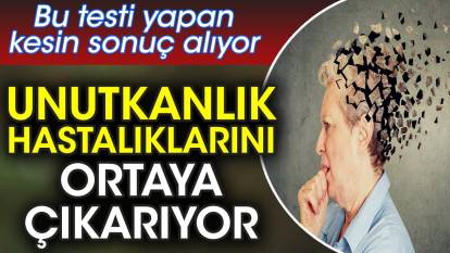 Unutkanlık hastalıklarını ortaya çıkarıyor. Bu testi yapan kesin sonuç alıyor