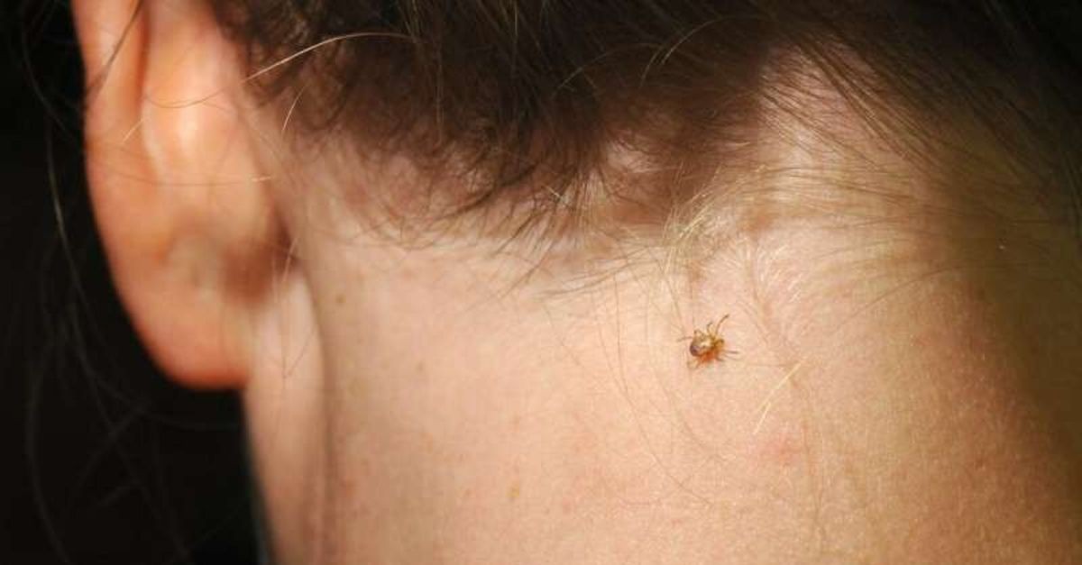 lyme-hastaligi-nedir-kimlerde-gorulur-lyme-hastaligi-belirtileri-nelerdir-h1588259152-e66400.jpg