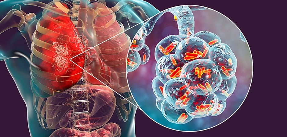 ntmlungdisease-subservice.jpg