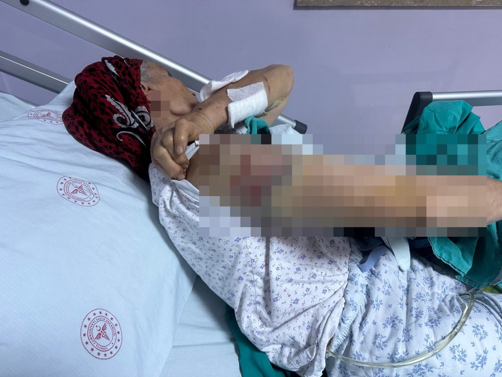 Yaşlı kadına 7 köpek dehşeti yaşattı: Vücuduna tam 50 dikiş atıldı!