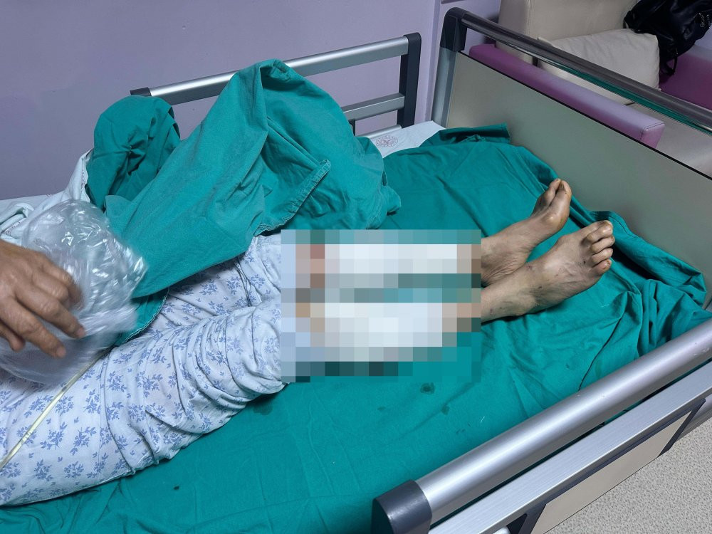 Yaşlı kadına 7 köpek dehşeti yaşattı: Vücuduna tam 50 dikiş atıldı!