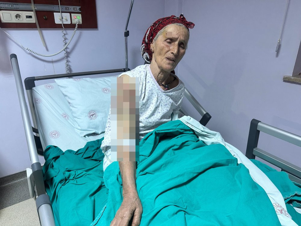 Yaşlı kadına 7 köpek dehşeti yaşattı: Vücuduna tam 50 dikiş atıldı!