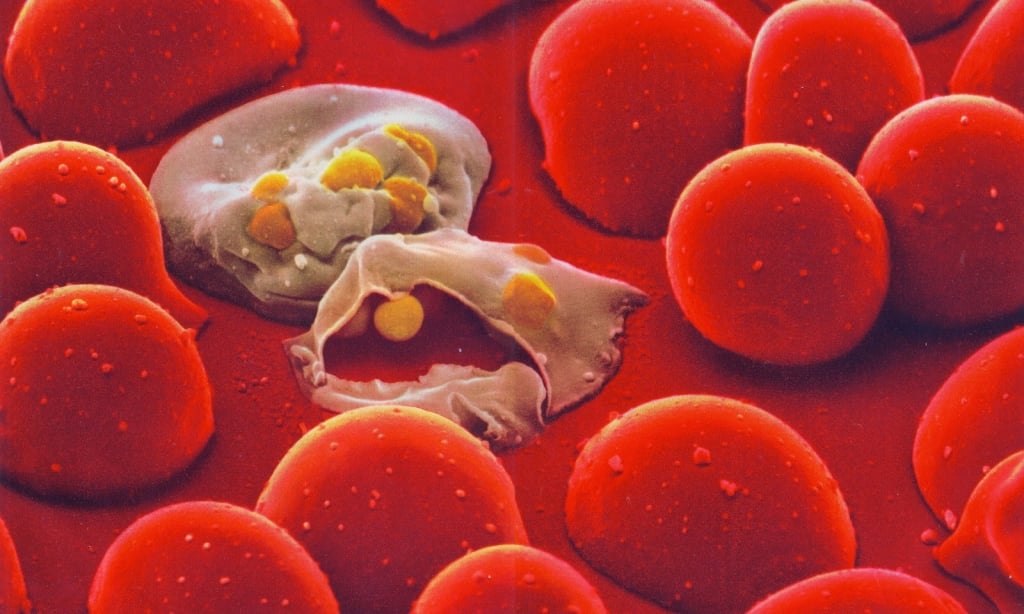 malaria-cells.jpg