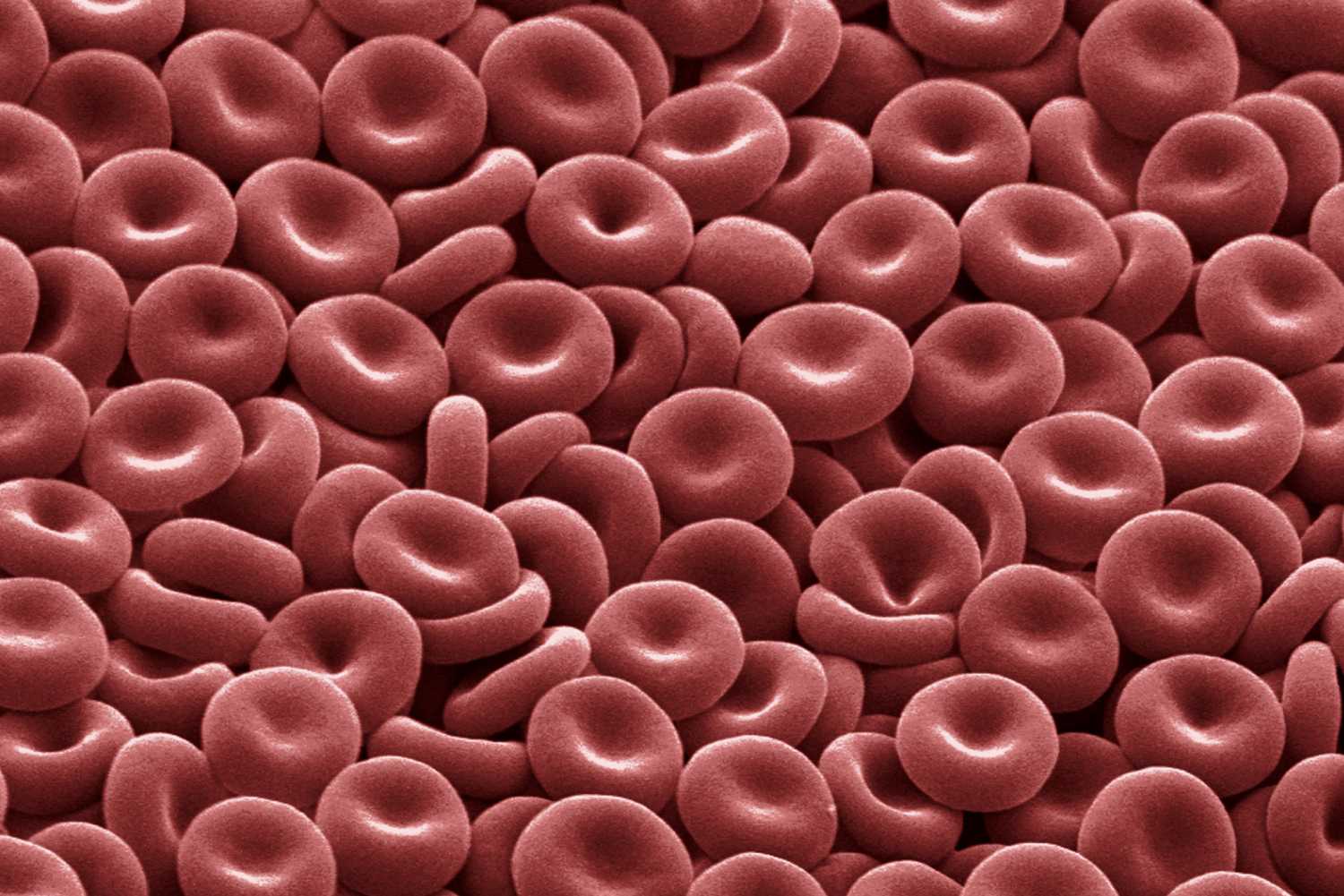 red-blood-cells-1-57b20c583df78cd39c2f8e15.jpg