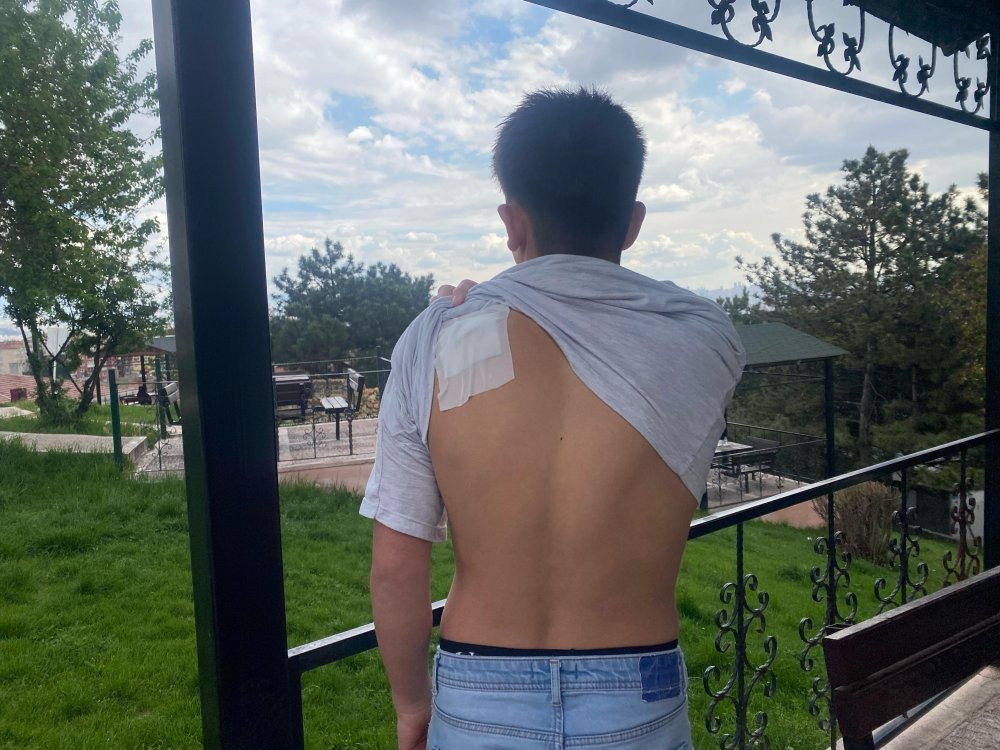 13 yaşındaki çocuk bıçaklandı! Şüpheliye verilen karara aile isyan etti!