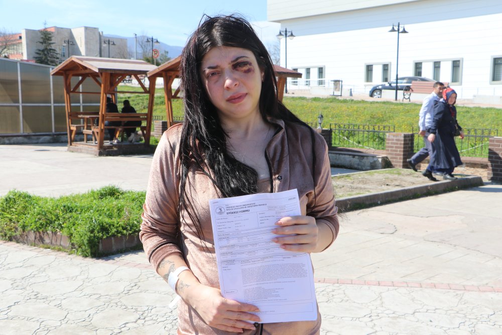 Sokak ortasında darp edilmişti! Damla olaydan sonra acı gerçeği açıkladı...