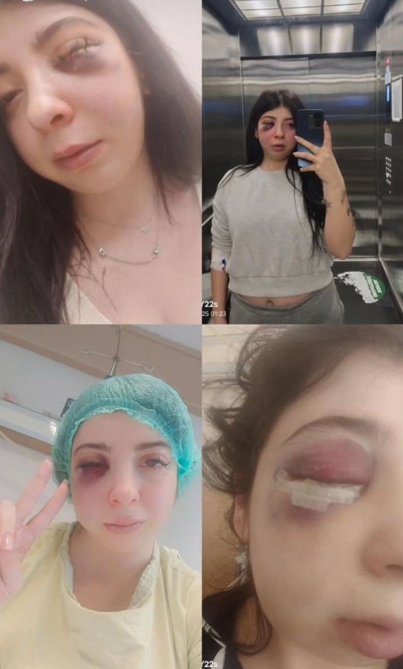Sokak ortasında darp edilmişti! Damla olaydan sonra acı gerçeği açıkladı...