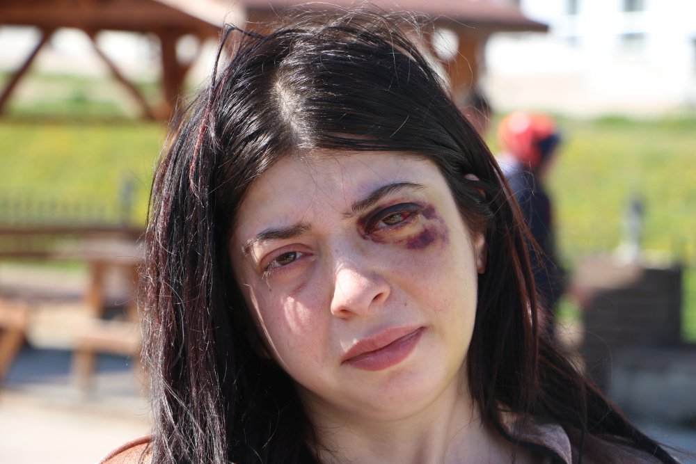 Sokak ortasında darp edilmişti! Damla olaydan sonra acı gerçeği açıkladı...