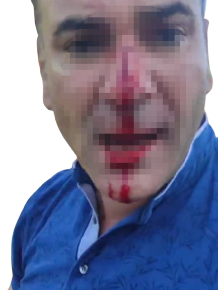 hasarli-kaza-sonrasi-baba-ogul-diger-s-754546-222683-removebg-preview-1.png