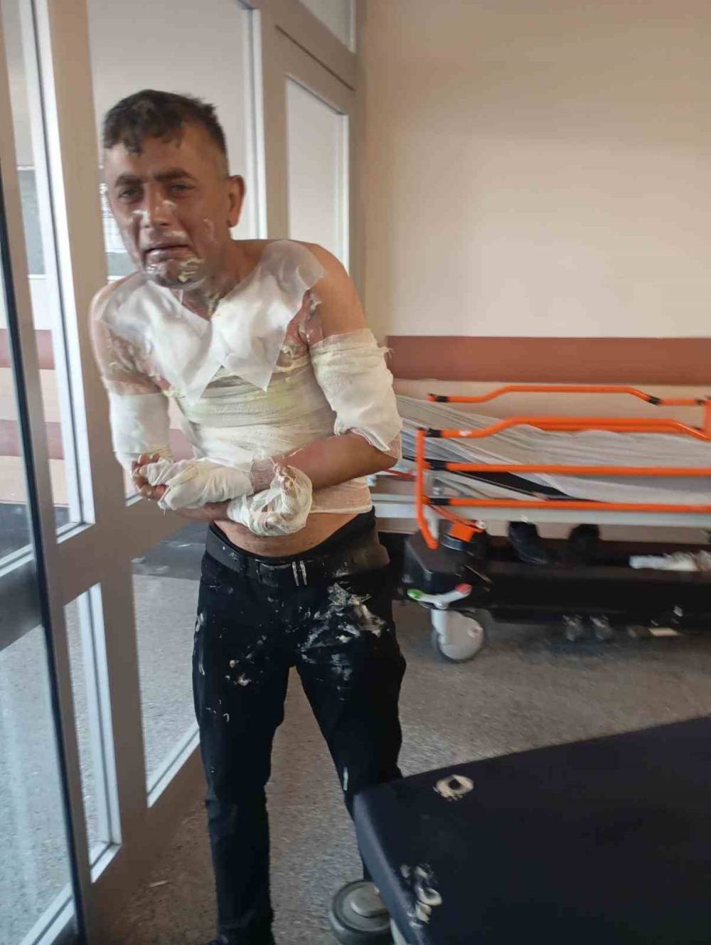 Engelli vatandaşa arazide dehşeti yaşattı: Benzin döküp diri diri yaktı!