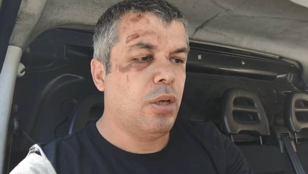 Cip sürücüsü öfkelenip vurdu! Sürücü bayıldı