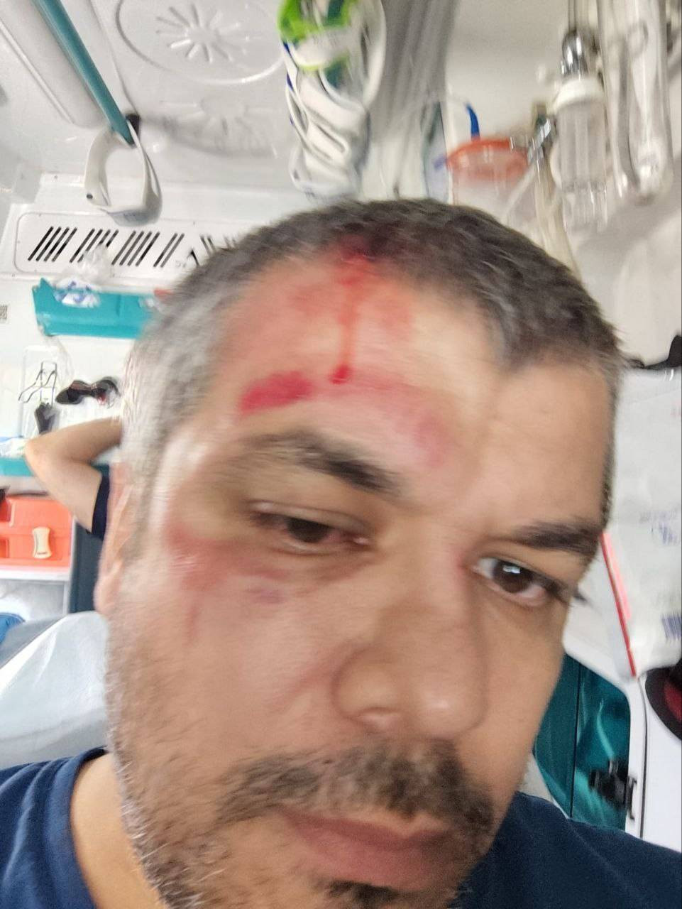 Cip sürücüsü öfkelenip vurdu! Sürücü bayıldı