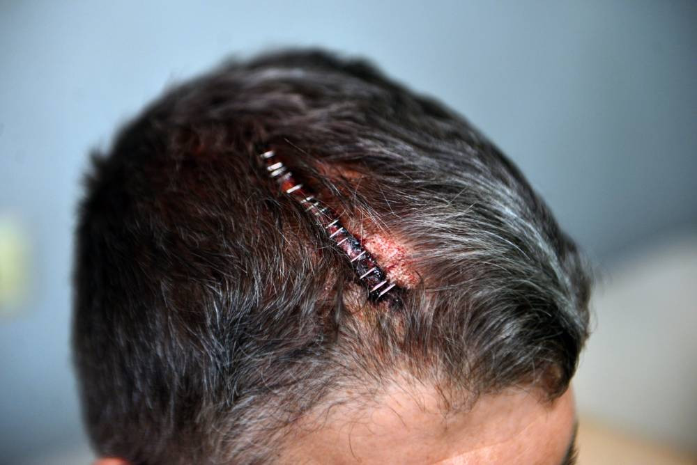 Yeğenine beyzbol sopasıyla dehşeti yaşattı!