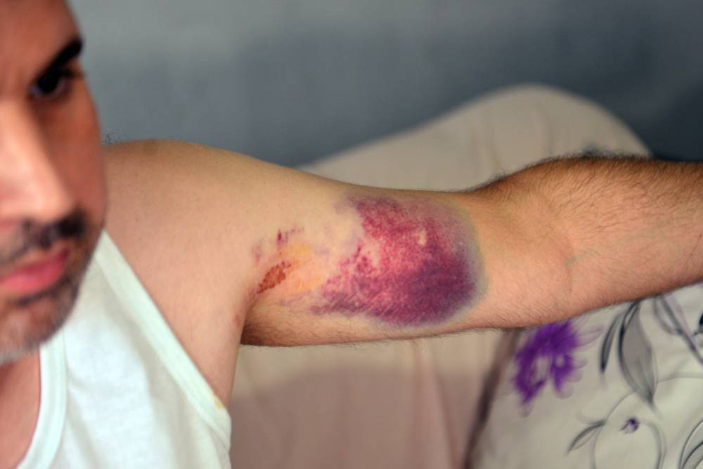 Yeğenine beyzbol sopasıyla dehşeti yaşattı!