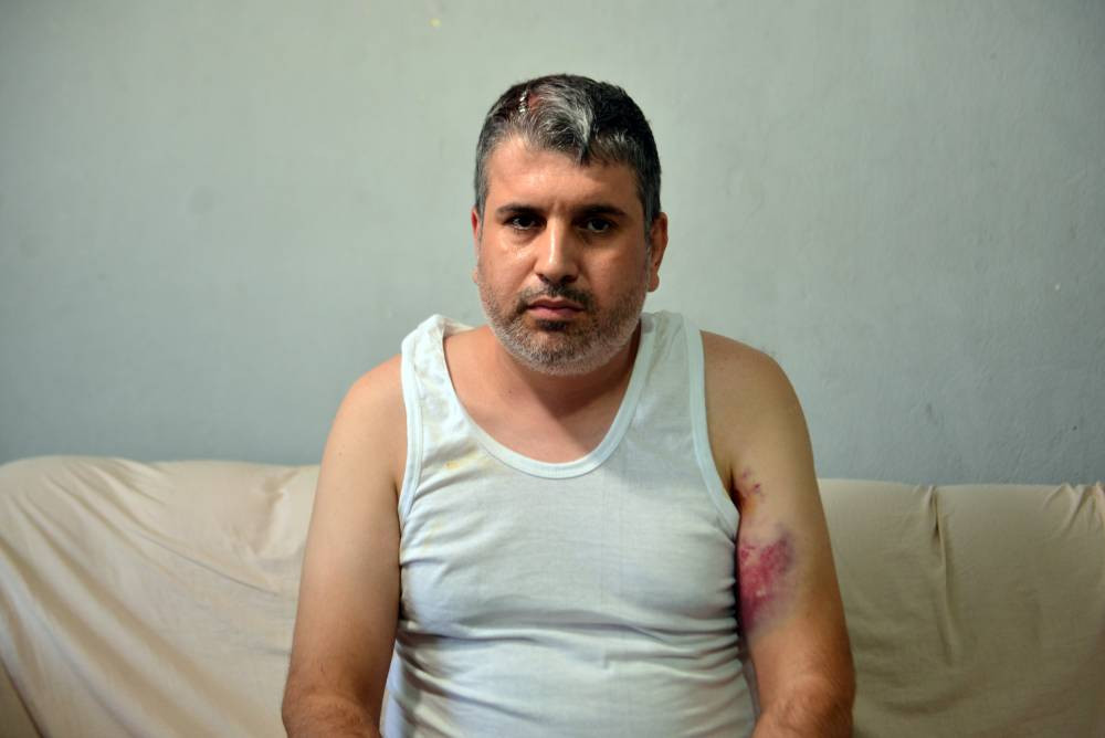 Yeğenine beyzbol sopasıyla dehşeti yaşattı!