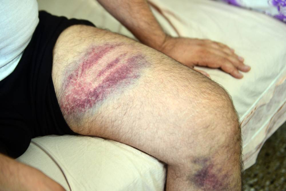 Yeğenine beyzbol sopasıyla dehşeti yaşattı!