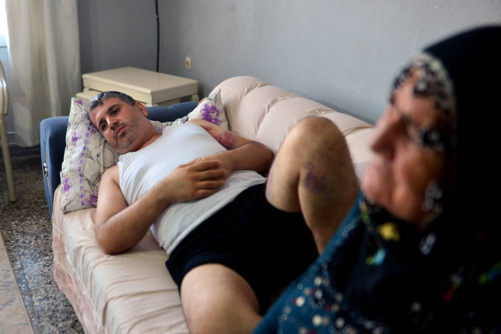 Yeğenine beyzbol sopasıyla dehşeti yaşattı!