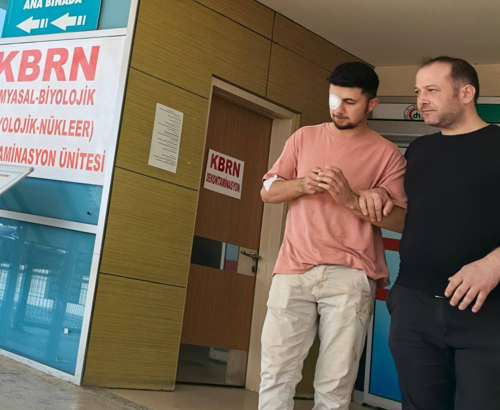 Mobilya fabrikasında feci kaza: Çivi gözüne saplandı!