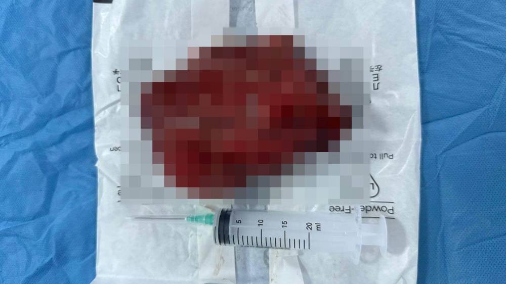 Kalbinin üzerinde çıkan doktorları bile şoke etti!