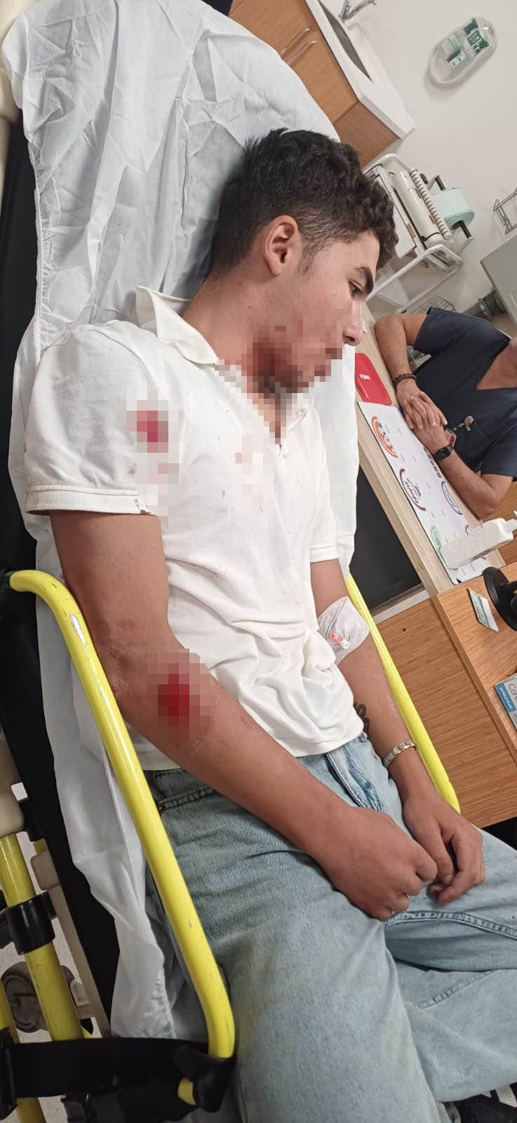 Ankara’da konser çıkışı vahşet! 8 kişi 14 yaşındaki çocuğu öldüresiye dövdüler