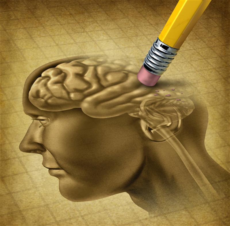 alzheimer.jpg