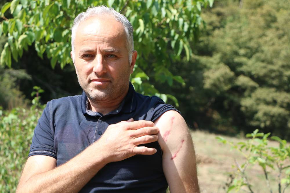 Köyde korku hâkim! Parmağı koptu: 20 yıl sonra aynı kâbusu yaşadı