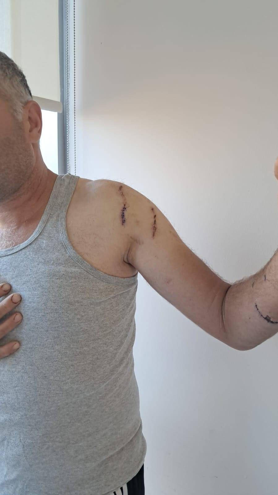 Köyde korku hâkim! Parmağı koptu: 20 yıl sonra aynı kâbusu yaşadı