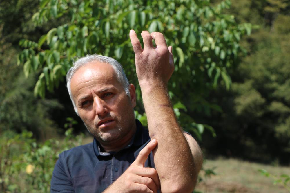 Köyde korku hâkim! Parmağı koptu: 20 yıl sonra aynı kâbusu yaşadı