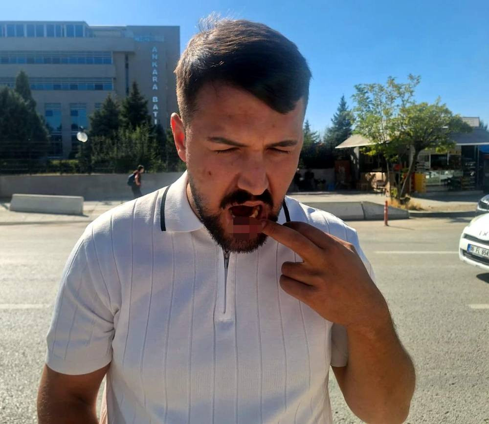 Taksi şoförünü sopayla dövmüşlerdi! 4 şüpheli tekrar yakalandı