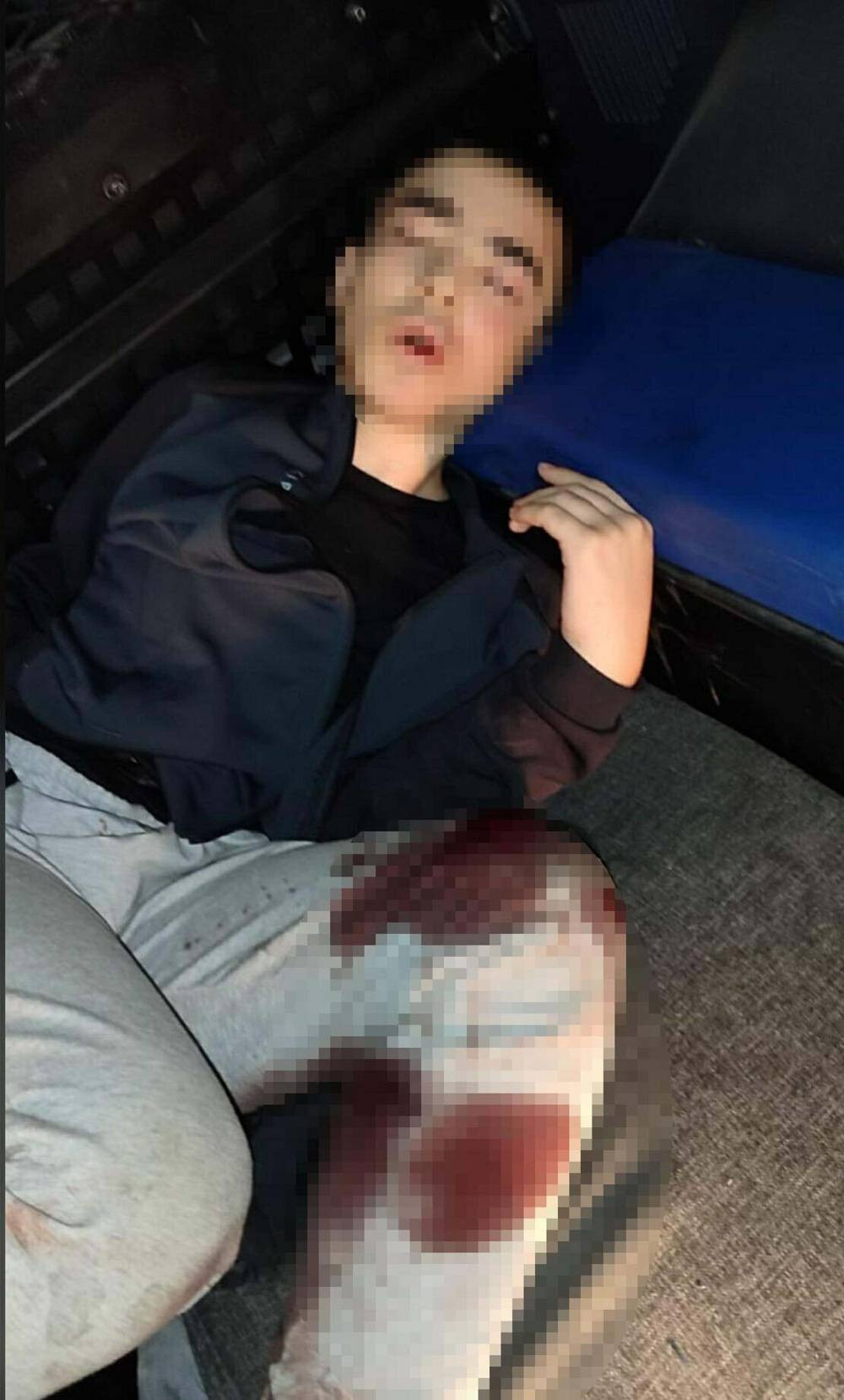 Polis memuru şehit oldu! İzmir’de karakola saldırı olayında üzücü haber