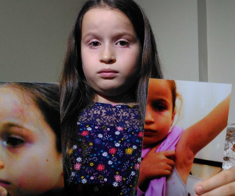 Diş doktoru 8 yaşındaki İrem'i darp etti - Resim : 1