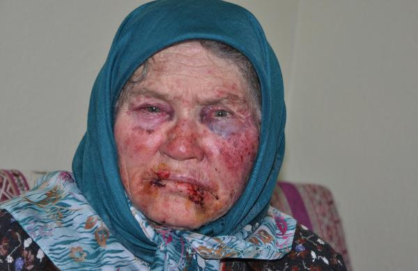 75 yaşındaki kadına öldüresiye dayak - Resim : 1