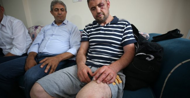 20 kişi, gaziyi darp etmişti: "Biz de mağdur olduk" - Resim : 1